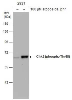 Western Blot: Chk2 [p Thr68] Antibody [NBP3-13076]